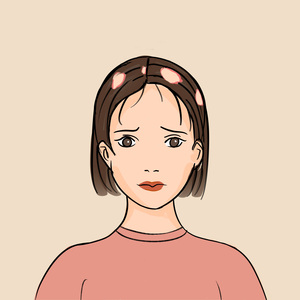 招募斑秃患者 | 进口乌帕替尼