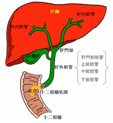 晚期胆管癌fgfr2基因融合怎么办?